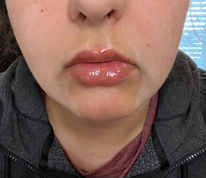 Customer carousel item 5.