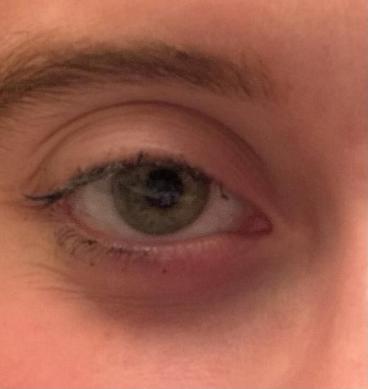 Before and After