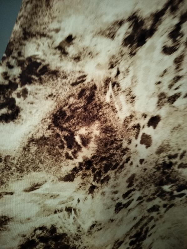 Photo from Nurse11