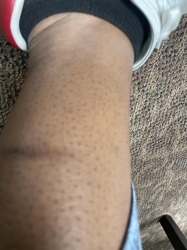 Boots rubbed really bad