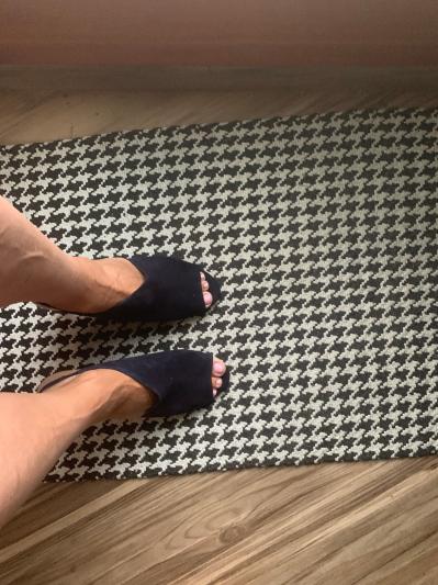 Slight gap in upper right arch