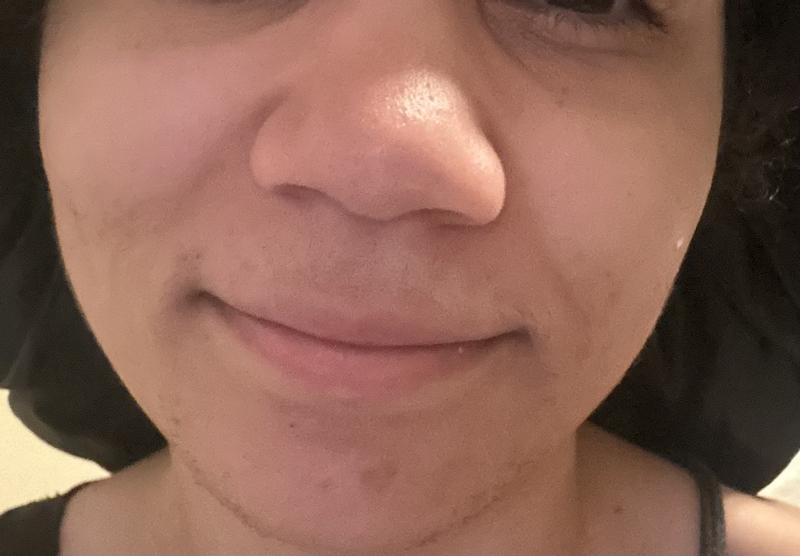 Photos of my natural skin without foundation