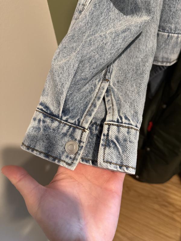 No button on the other side of the sleeve