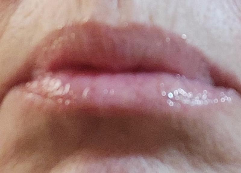 After lip maximizer