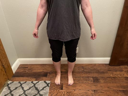 Untucked shirt to show normal wear