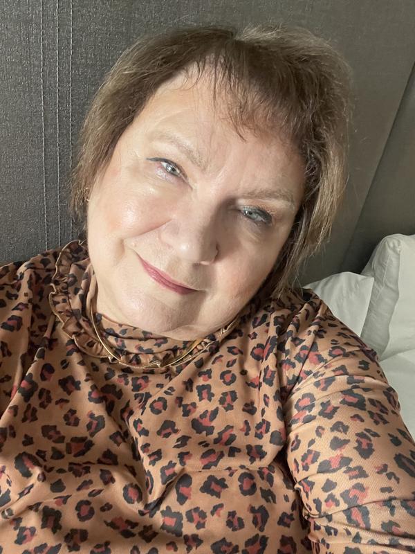 Out of town and only took essentials