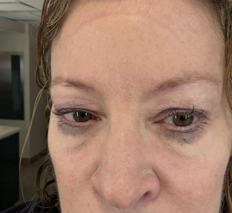 Customer carousel item 1.