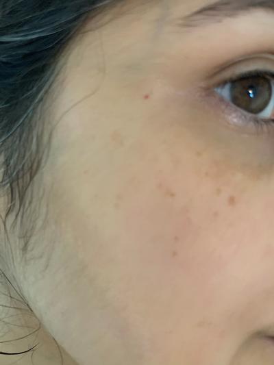 Applied only to on patch of skin.. Look at the difference!