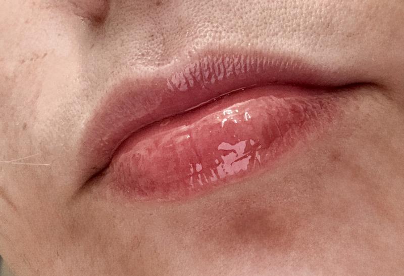 Customer carousel item 11.