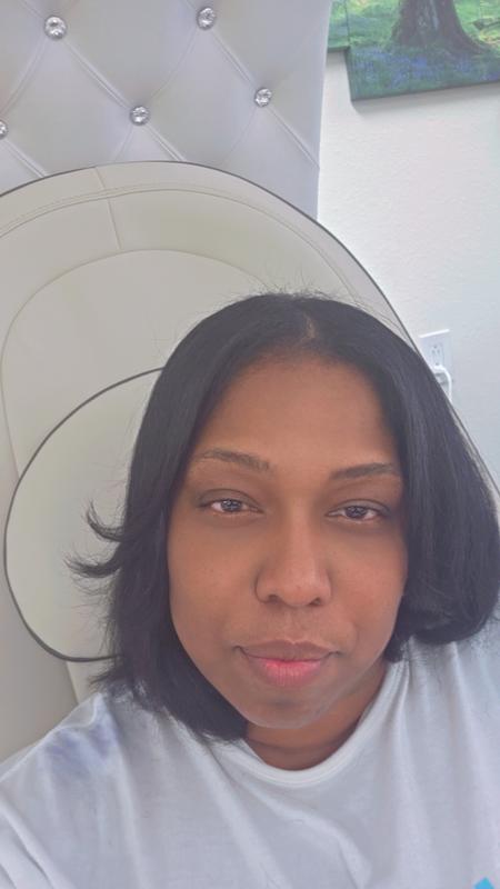 No undereye puffiness