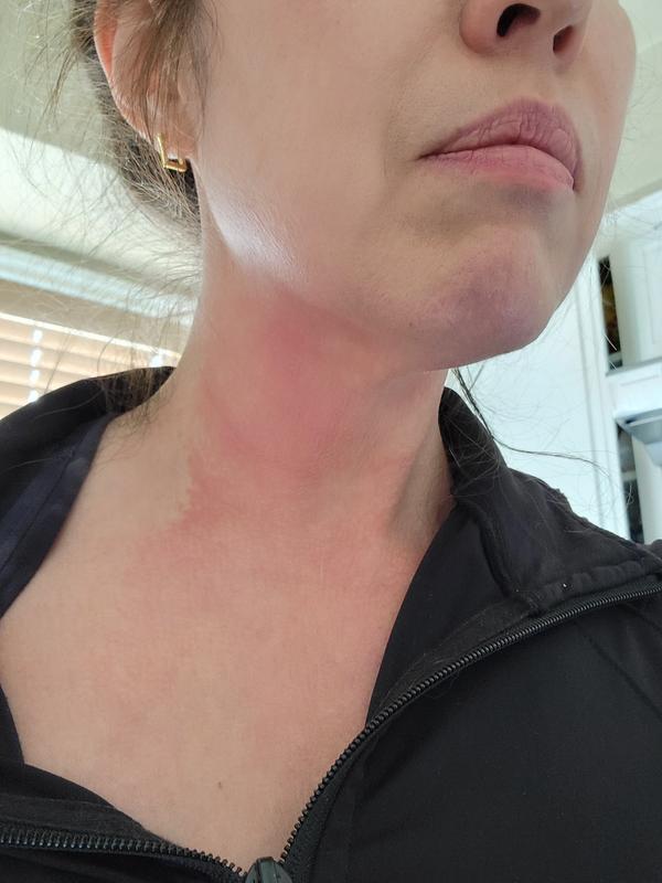 🦞 Resembling a Lobster