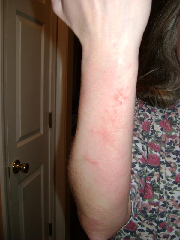 Customer carousel item 1.