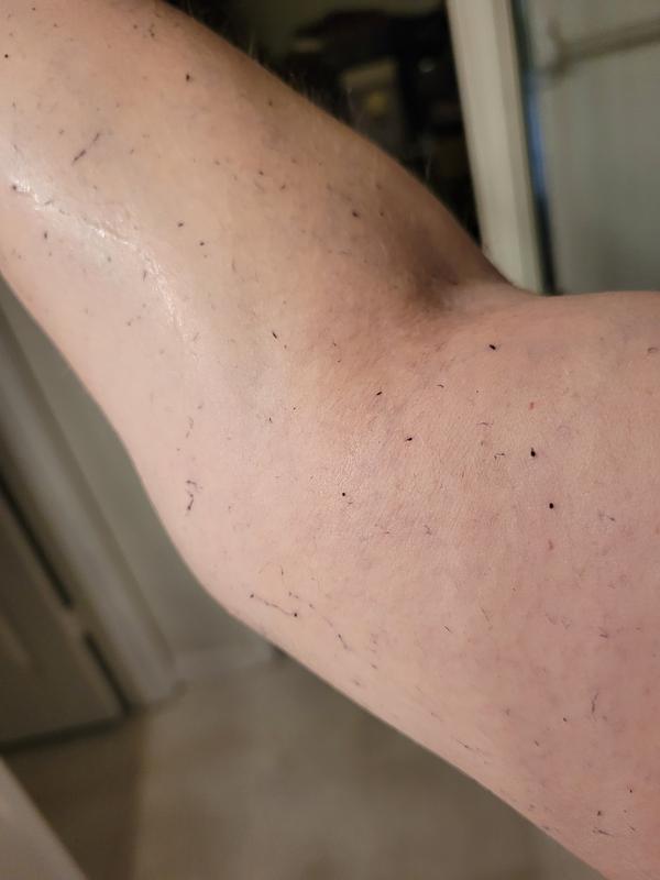 Lint left over on my arm post-shower