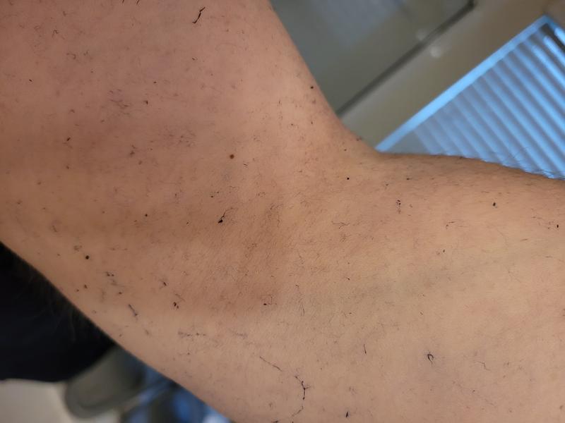Leftover lint on my arm