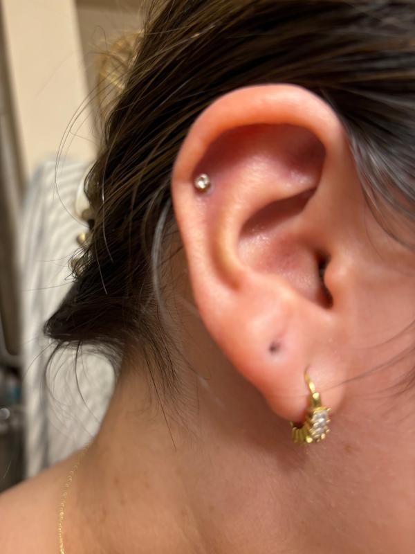 Customer photo for "Horrible"