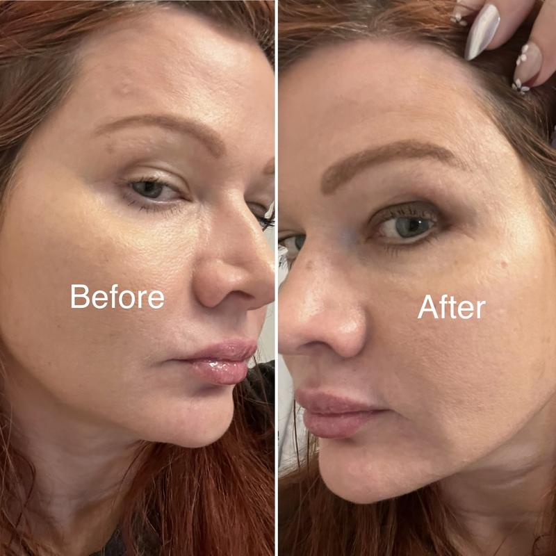 Review Thumbnail Image 1 179858017