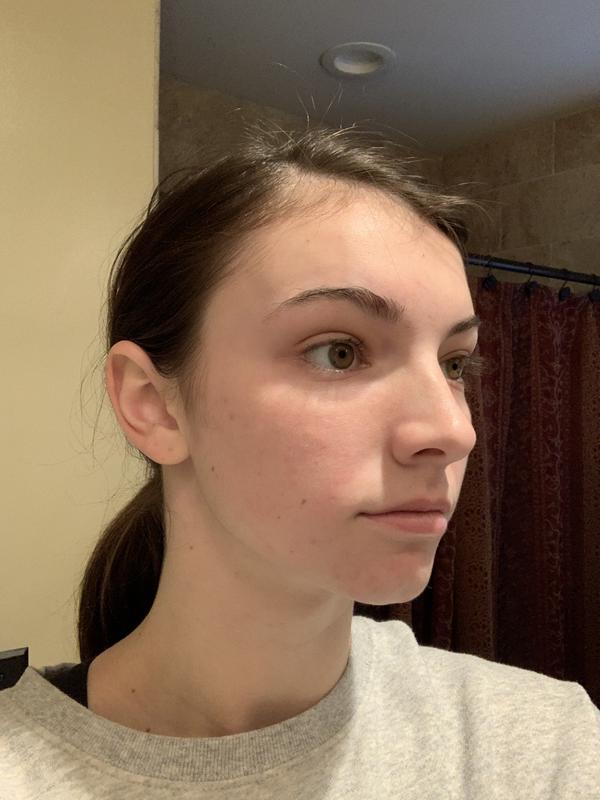 Makeup Forever Green Primer Before After Saubhaya Makeup