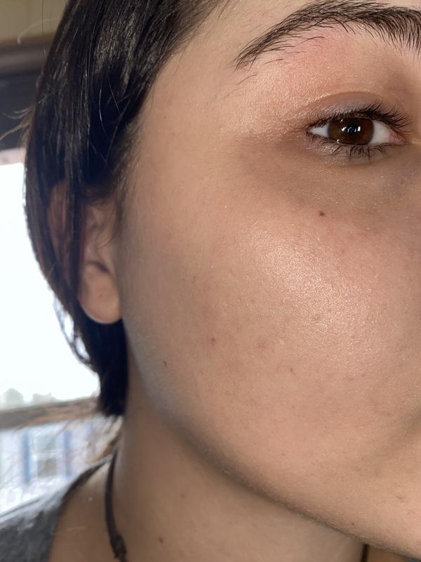 Makeup Forever Green Concealer Review Saubhaya Makeup