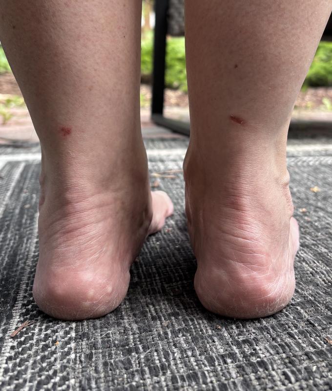 Minor rubs from 1st wear.