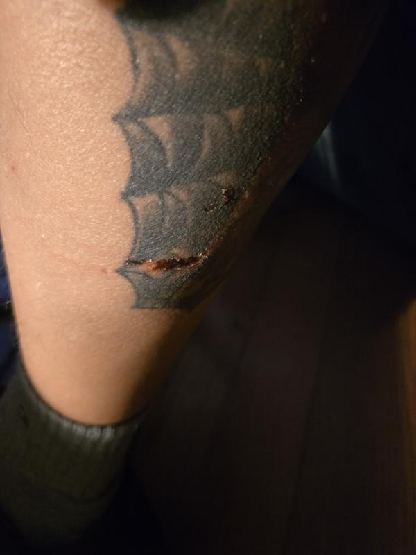 Cut on my leg