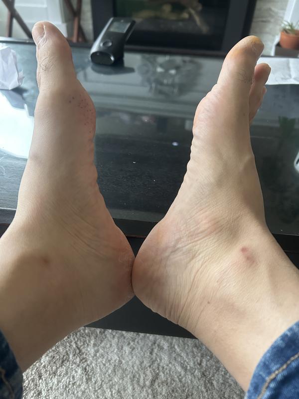 Hurts after wearing