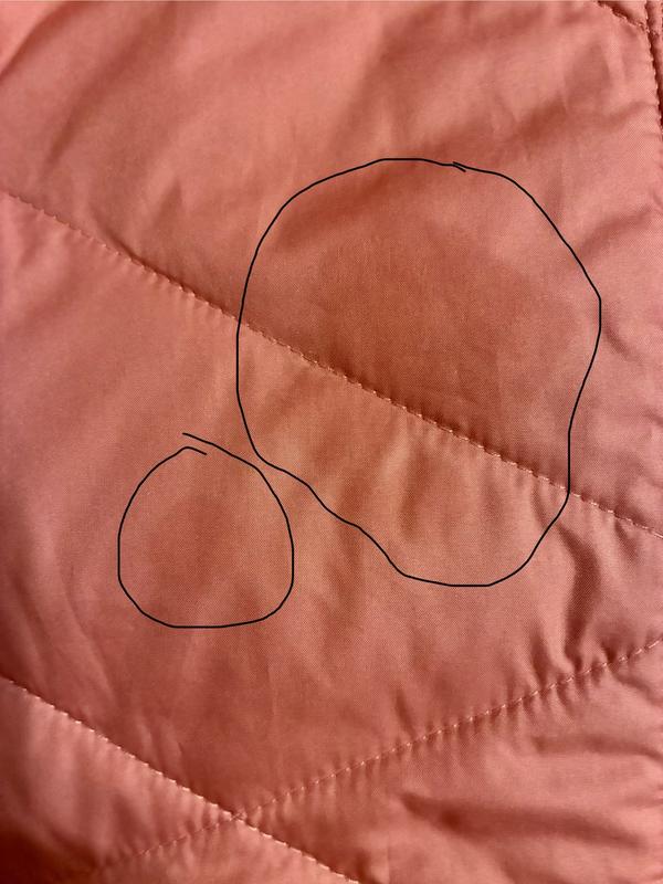 Multiple grease stains on front of jacket