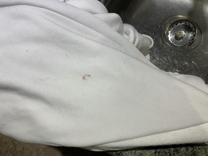 Hole in the leather