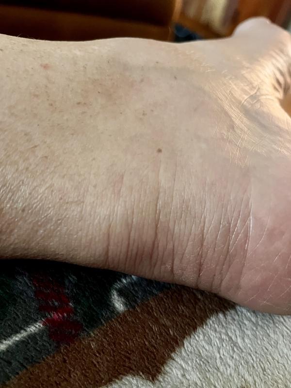 Ouch! Caused lump and pain!