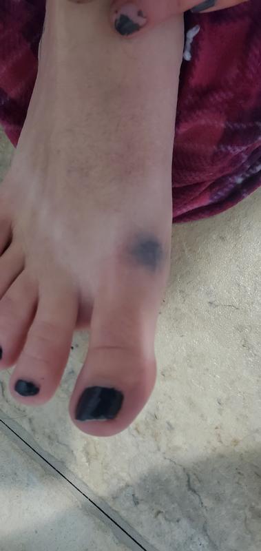 Ink being left on my foot from the boots be soaked from snow