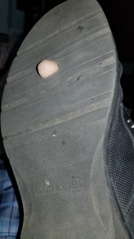 Hole in my shoe.