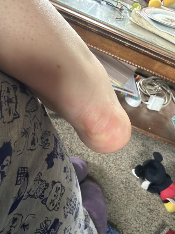 Healed heels - over 2 months to break in