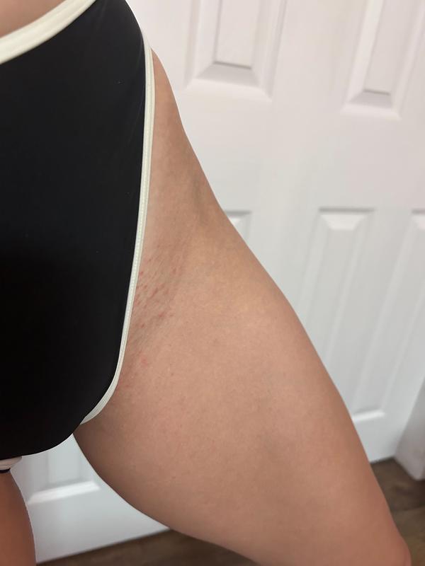 Customer photo for "Overnight Results! Vacation HERO"