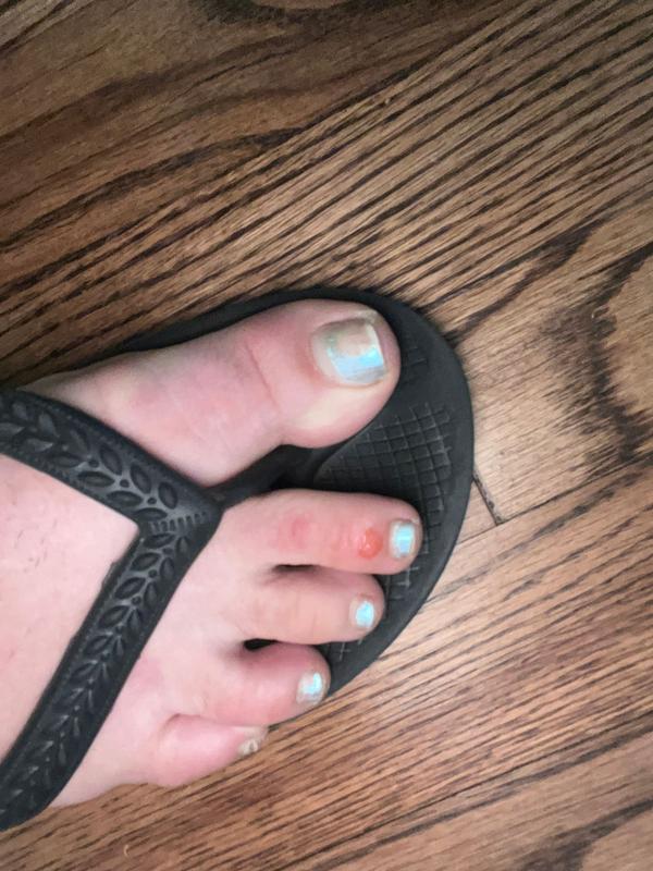 Customer photo for "Very cute but the tops of my toes are rubbed raw."