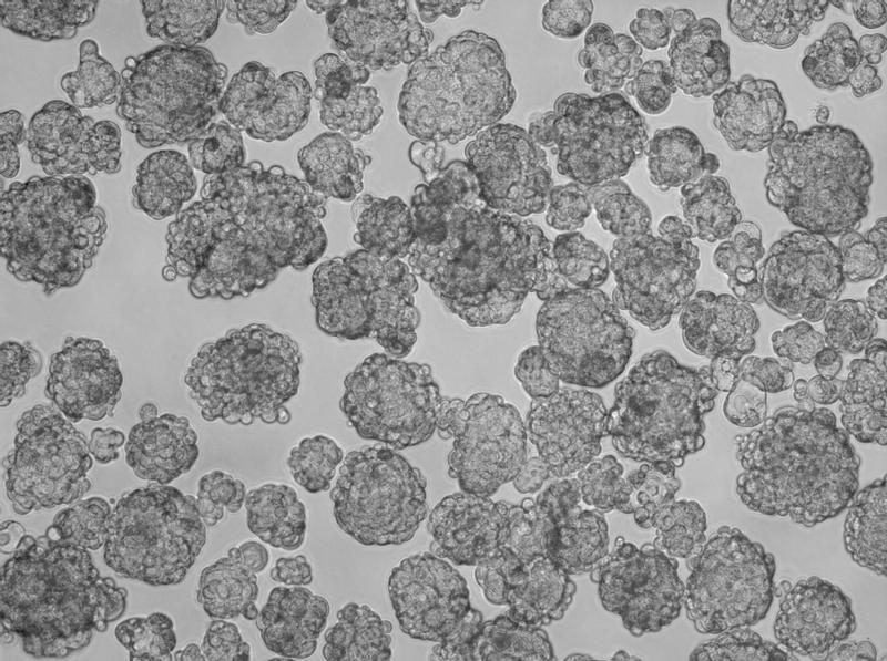 MCF-7 breast cancer cells (estrogen-reponsive) in 3D Tumorsphere Medium