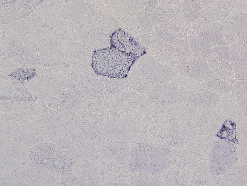 Succinic Dehydrogenase Test for mitochondrial enzymes