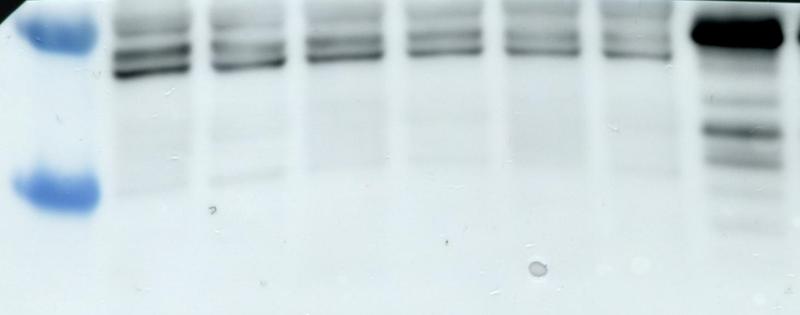 WB using protein extracted from mouse cerebellum and cortex, seablue ladder on the left and positive control (bit high, but in line with M1 isoform) on the right. Primary/ secondary concs 1:1000 (1% BSA), nitrocelulose membrane blocked in 5% BSA.