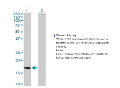 SAB1410671 Western Blot Image