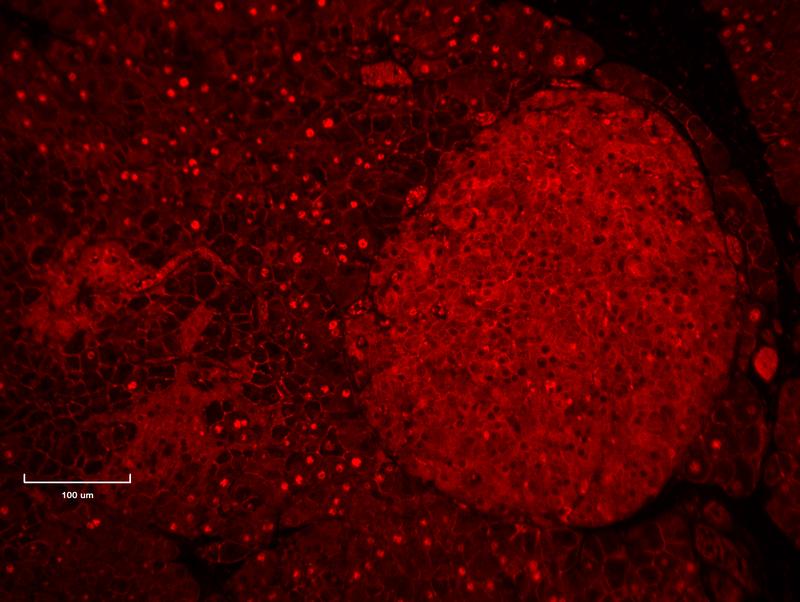 No reactivity observed in the pancreatic islet
