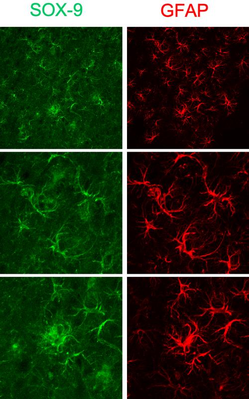 Sox9 antibody was used at 1/1000.  GFAP staining is also coming through Airyscan.