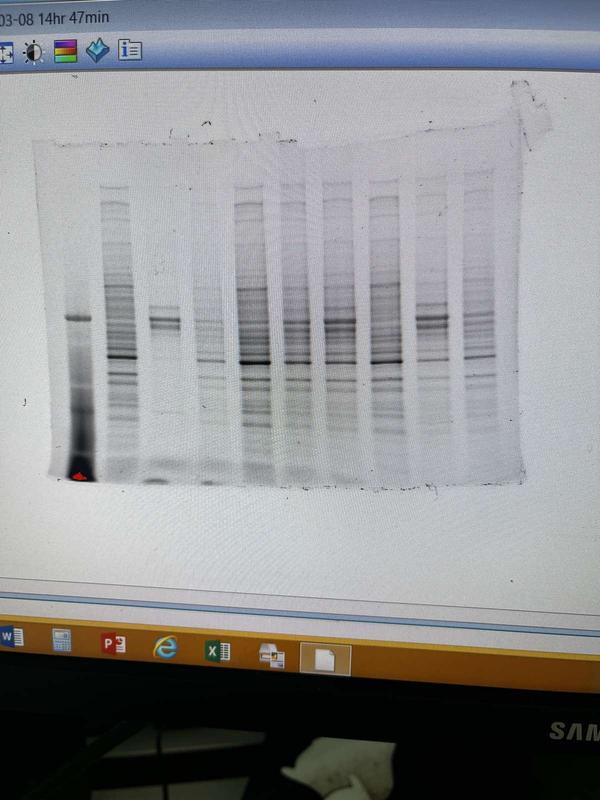 Membrane with HaCaT lysates after the transfer from BioRad stain free gel, before the Ab