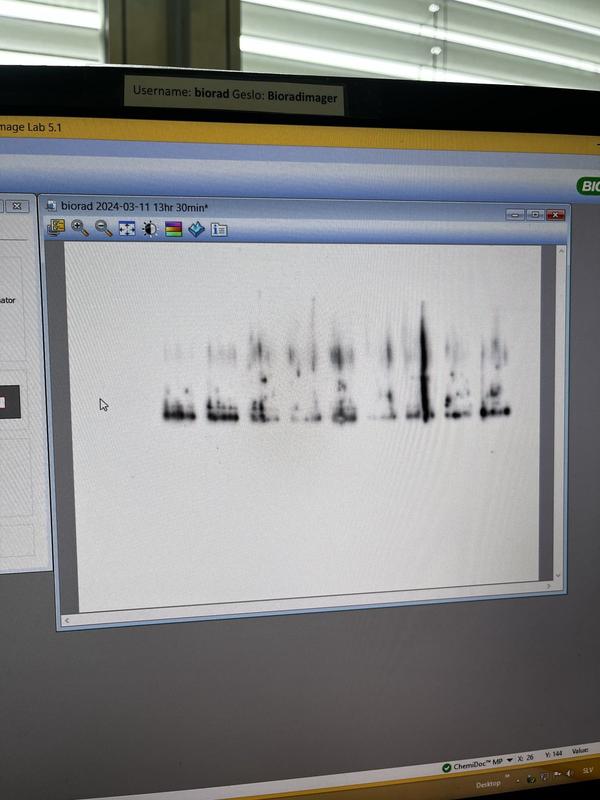 WB of HaCaT cell lysates, recommended dilution, Nitrocelulose membrane, the next image is the membrane after the transfer, cell lysates are fine