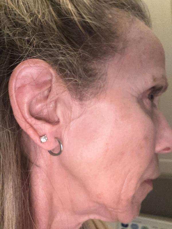 Customer photo for "Mini hoops"