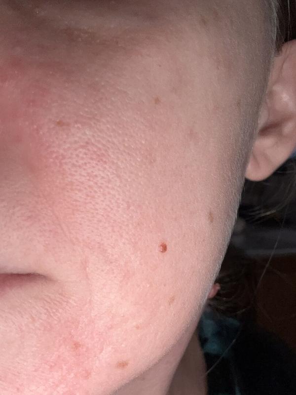 Review Thumbnail Image 0 366304320