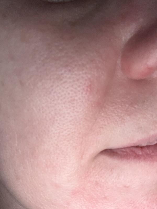 Customer photo for "Love this essence! Been using for years and everyone I recommend gets hooked!"