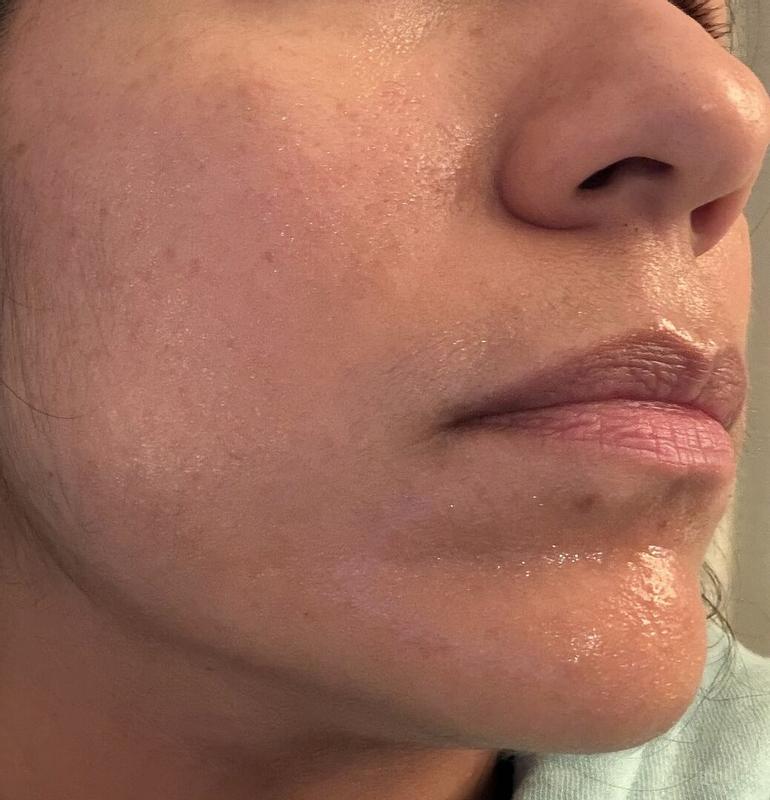 Review Thumbnail Image 0 377192607