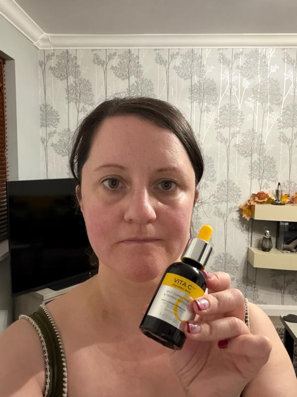 Customer photo for "Permanent staple!"