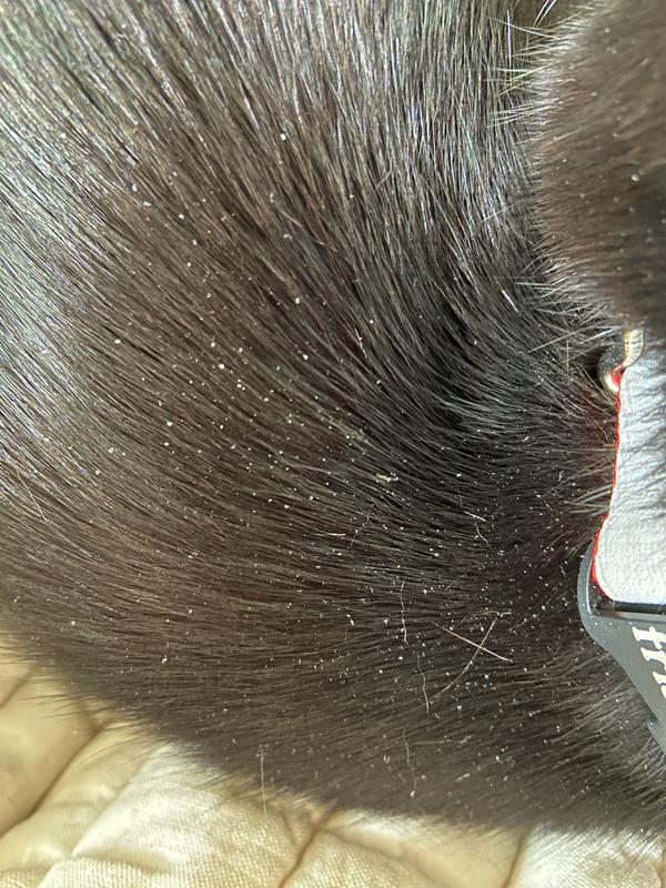 flaky skin before RC