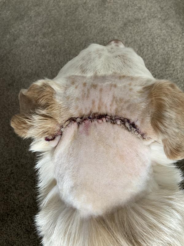Incision from surgery.