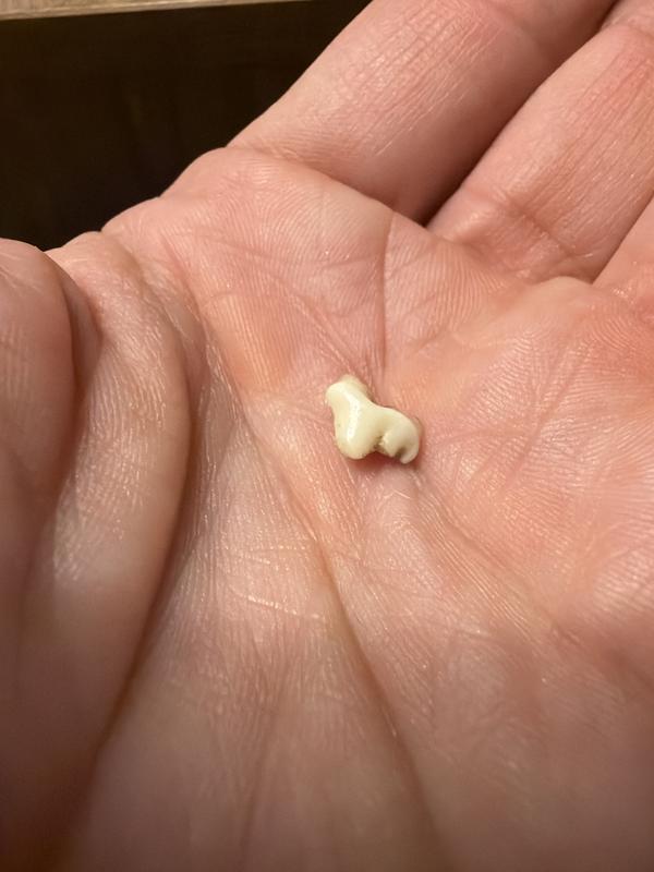 Caused a tooth to come out 😢