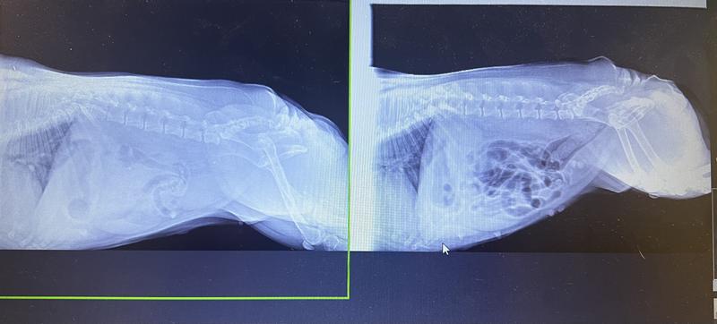 Before and after xray